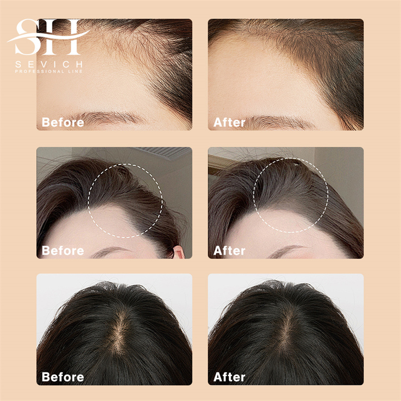 Hairline Shadow Powder Black R - Rooting Hormone Powder review and price